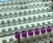 http://www.galilcol.ac.il/spa/Courses/5093/Gesti%C3%B3n_y_Control_del_VIH_%7Cfs%7C_SIDA_y_Enfermedades_Infecciosas